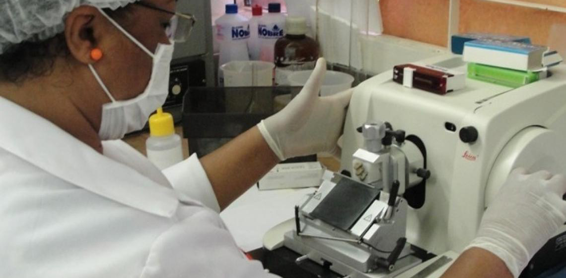 Pesquisa apoiada pela FAPDF abre caminho para novas terapias contra o câncer de cabeça e pescoço