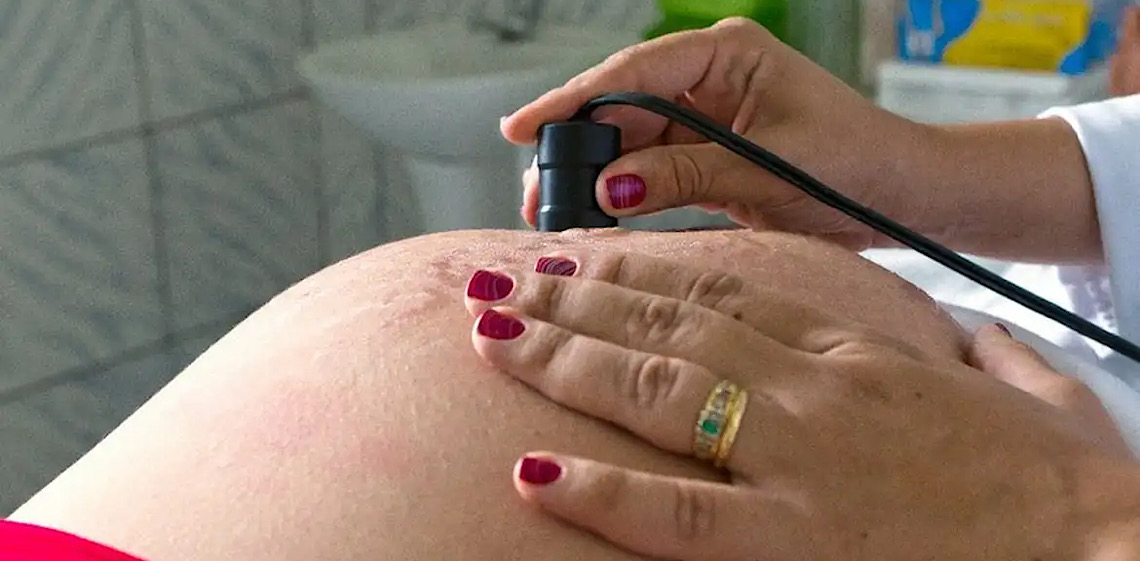 O que acontece com o corpo na gravidez? Entenda porque meninas de até 15 anos correm maior risco