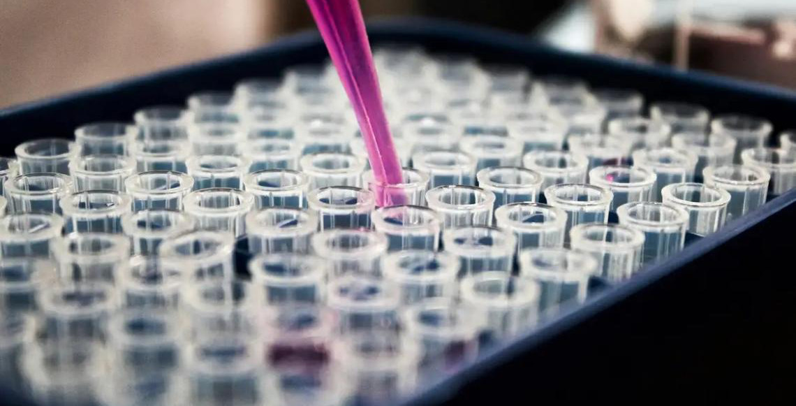 Estudo mostra que inflamação no cérebro pode ser chave do Alzheimer