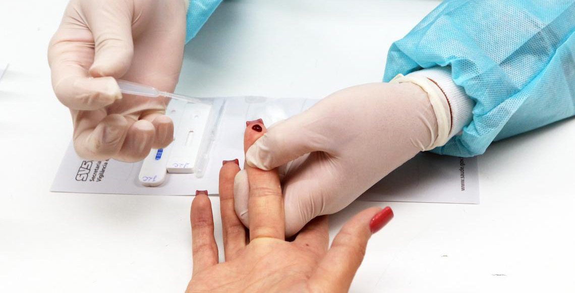 Luta contra o HIV no DF: SCS recebe testagem rápida na segunda-feira