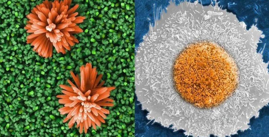 Duas imagens captadas por microscópios do Cetene ganham prêmio