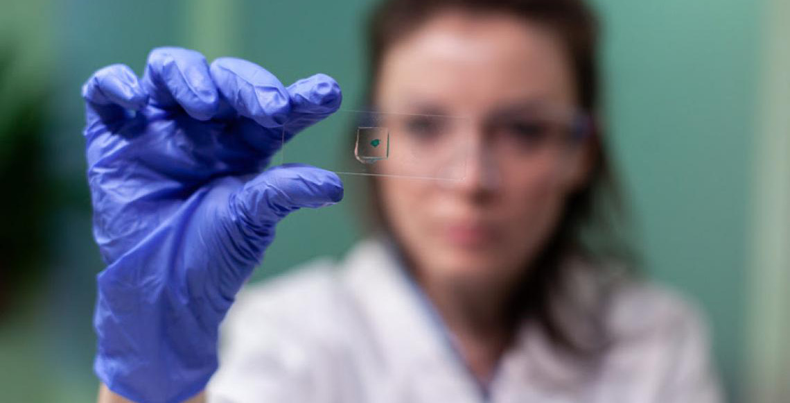 Eficaz na detecção precoce do câncer de colo de útero, genotipagem do HPV deve ser feita a partir dos 25 anos