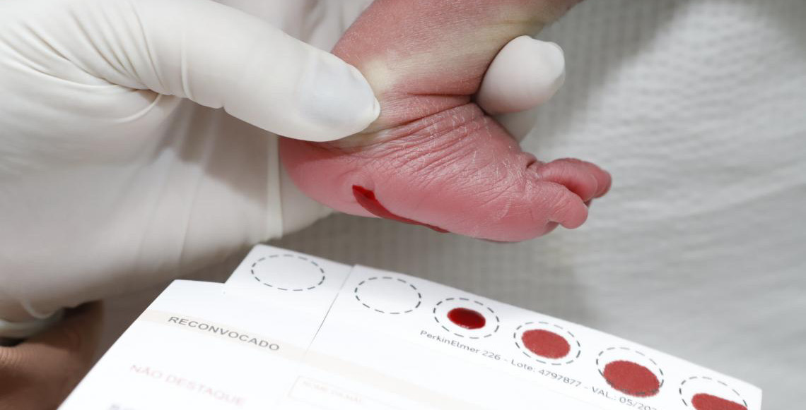 Distrito Federal amplia Teste do Pezinho e registra alta no número de exames em 2025