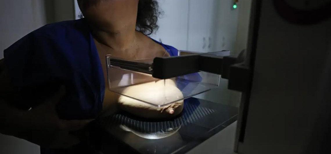 92% das brasileiras entre 50 e 69 anos fizeram mamografia, informação é da Vigitel