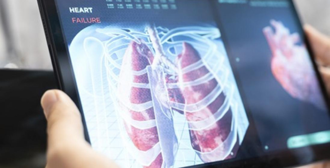 Broncopneumonia: Entenda quadro que causou internação de Bolsonaro