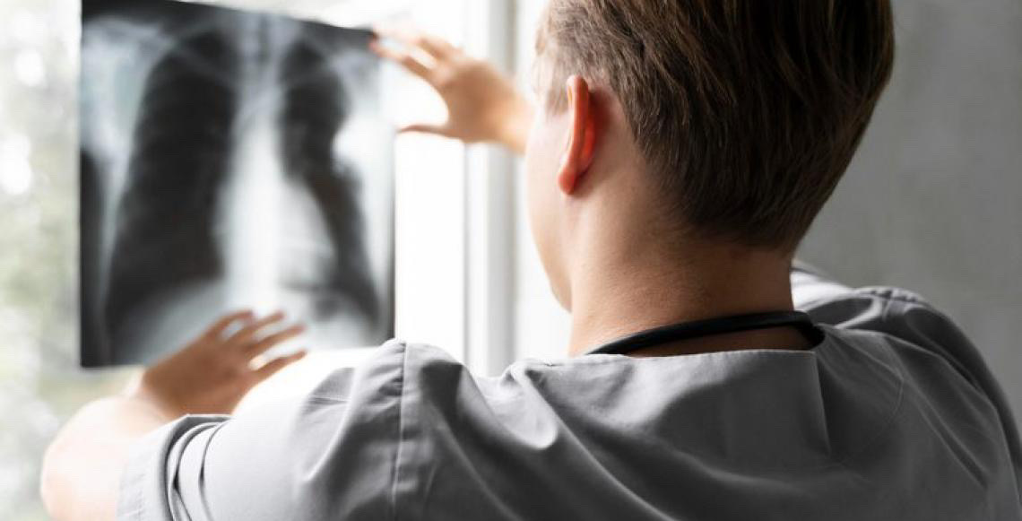 Agência Nacional de Vigilância Sanitária-Anvisa aprova mais um produto para tratamento de câncer de pulmão