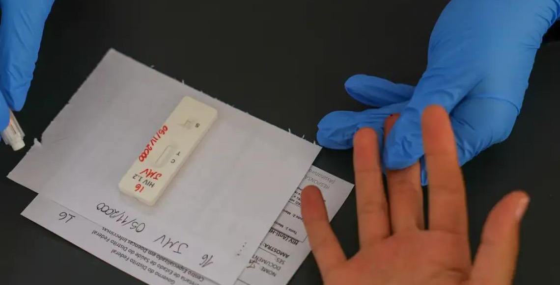 Estudo inédito da Fundação Oswaldo Cruz-Fiocruz pode ampliar prevenção de HIV entre jovens