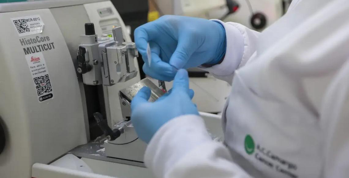 Sistema Único de Saúde incorpora medicamento para tratamento de leucemia mielóide aguda