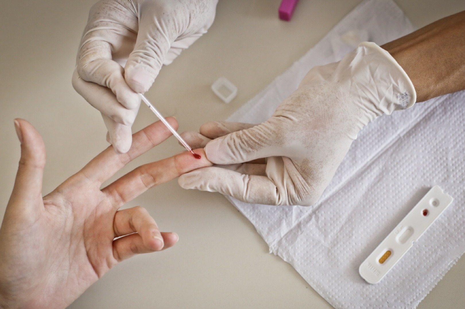 Preconceito contra pacientes com HIV ainda afasta pessoas de diagnóstico e cuidado