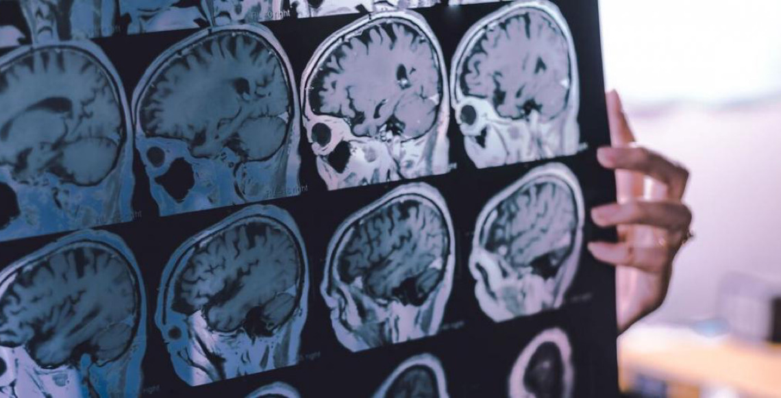 OMS afirma que até 45% do risco de demência pode ser prevenido ou adiado