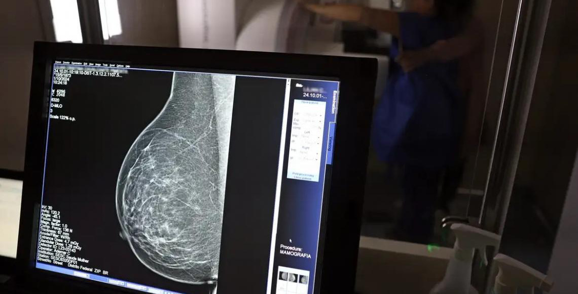 Plano de saúde terá que cobrir mamografia digital para todas as idades