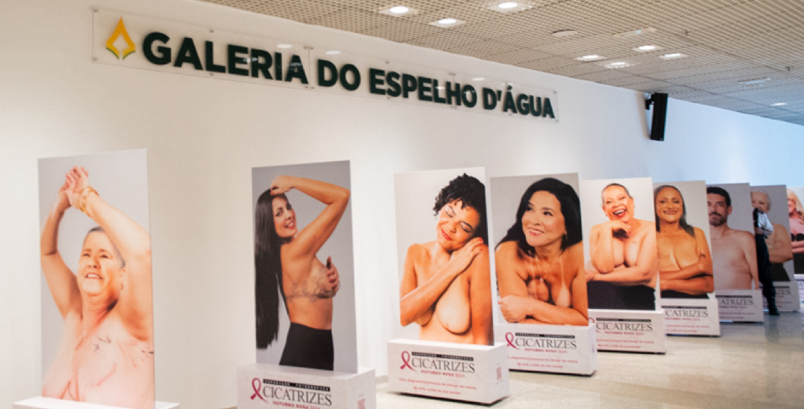 Exposição fotográfica “Cicatrizes” alerta sobre o câncer de mama, como parte do Outubro Rosa