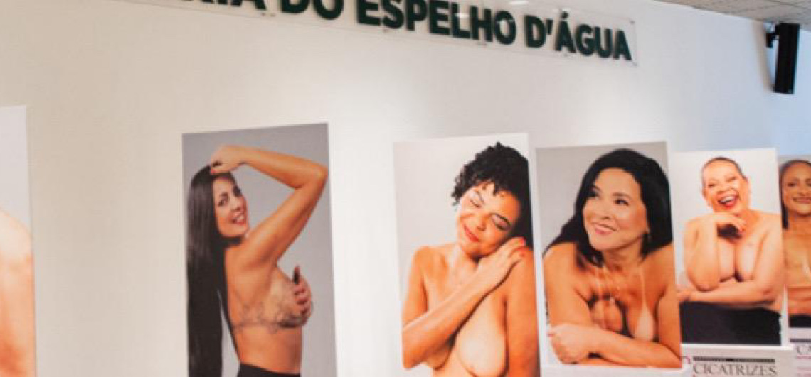 Exposição fotográfica “Cicatrizes” alerta sobre o câncer de mama, como parte do Outubro Rosa
