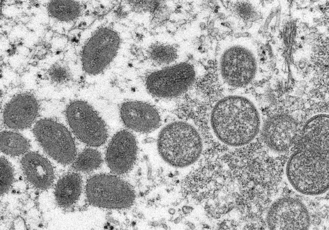 Distrito Federal registra o primeiro caso de varíola dos macacos