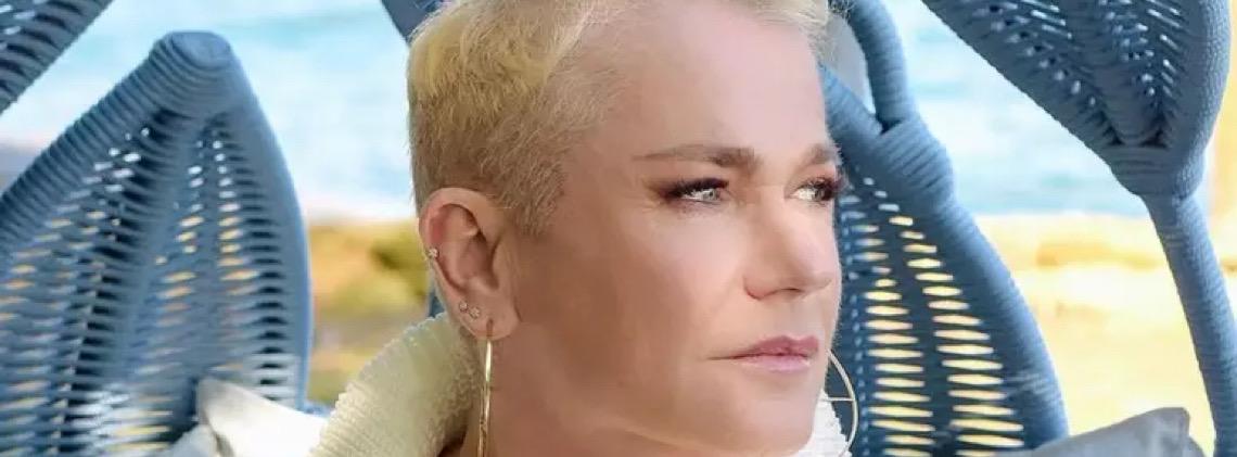 'Incentivar mulheres', diz Xuxa sobre implante capilar para lidar com queda de cabelo