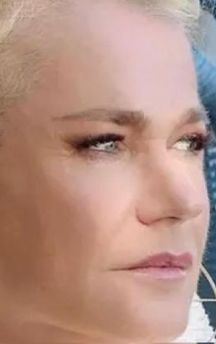 'Incentivar mulheres', diz Xuxa sobre implante capilar para lidar com queda de cabelo