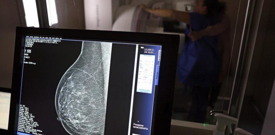 AGU pede condenação de médico que acusou nas redes mamografia como causa de câncer