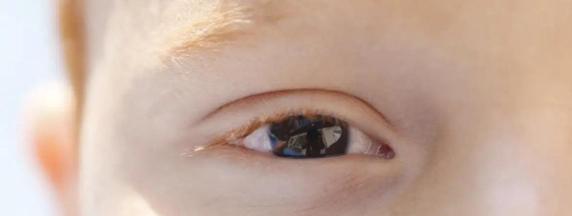 Cartilha sobre saúde ocular na infância orienta pais e professores