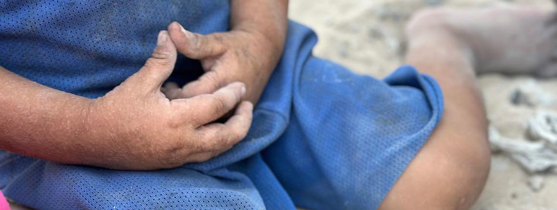 Organização das Nações Unidas-ONU diz que mais de 500 mil pessoas em Gaza estão passando fome