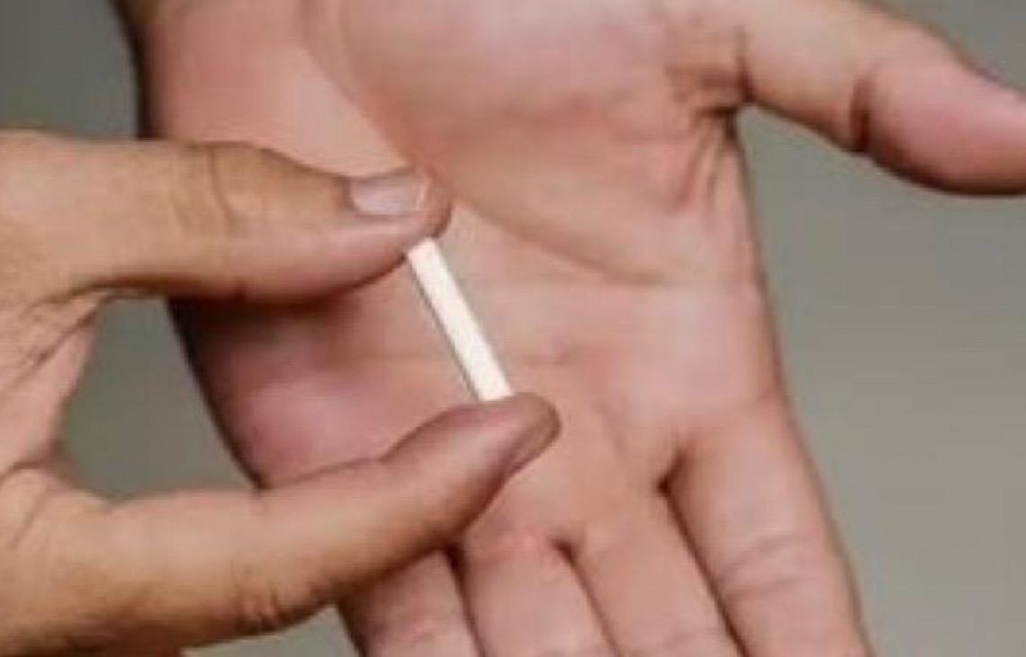 Implante contraceptivo deve ser ofertado por planos de saúde