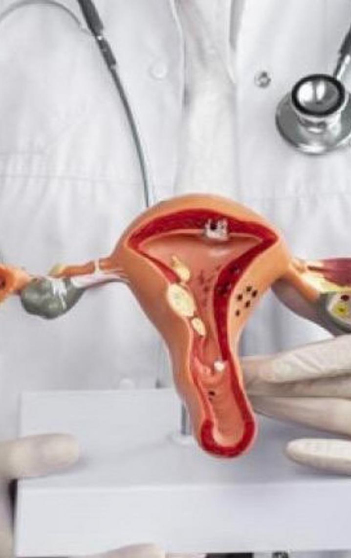 Seis em cada dez brasileiras desconhecem relação entre HPV e câncer de colo do útero