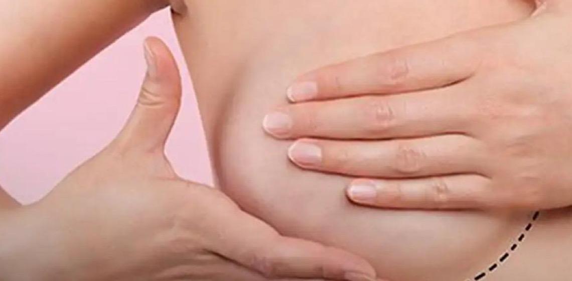 Inca estima 73,6 mil novos casos de câncer de mama no Brasil em 2025 