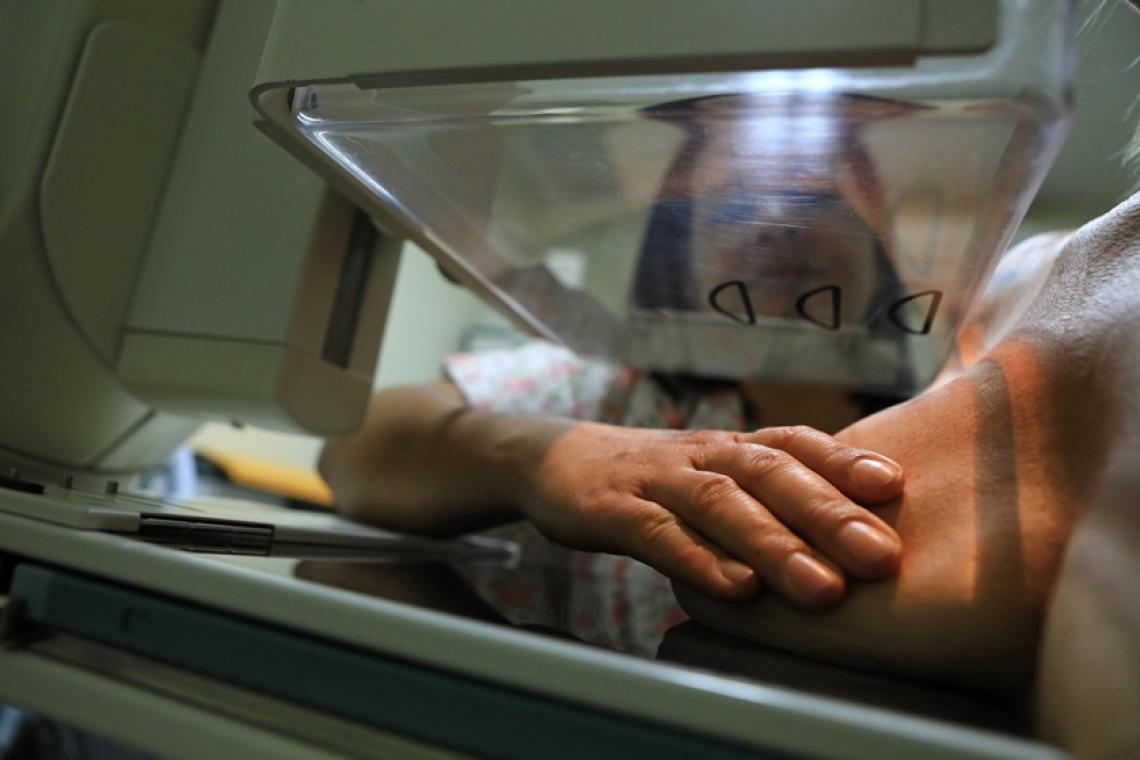 Acordo assinado entre Secretaria de Saúde do DF e Instituto BRB visa agilizar acesso a mamografias