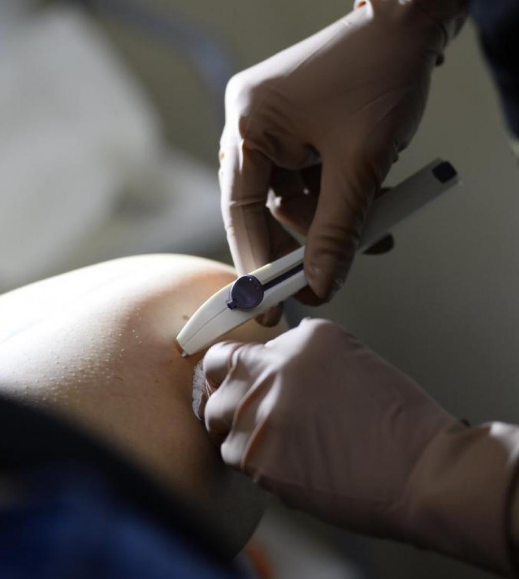 Novo método contraceptivo Implanon está disponível nas unidades básicas de saúde do DF