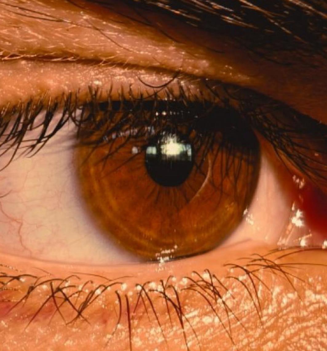 Pesquisa apoiada pela FAPDF busca explicar circulação de líquido essencial ao funcionamento do sistema ocular