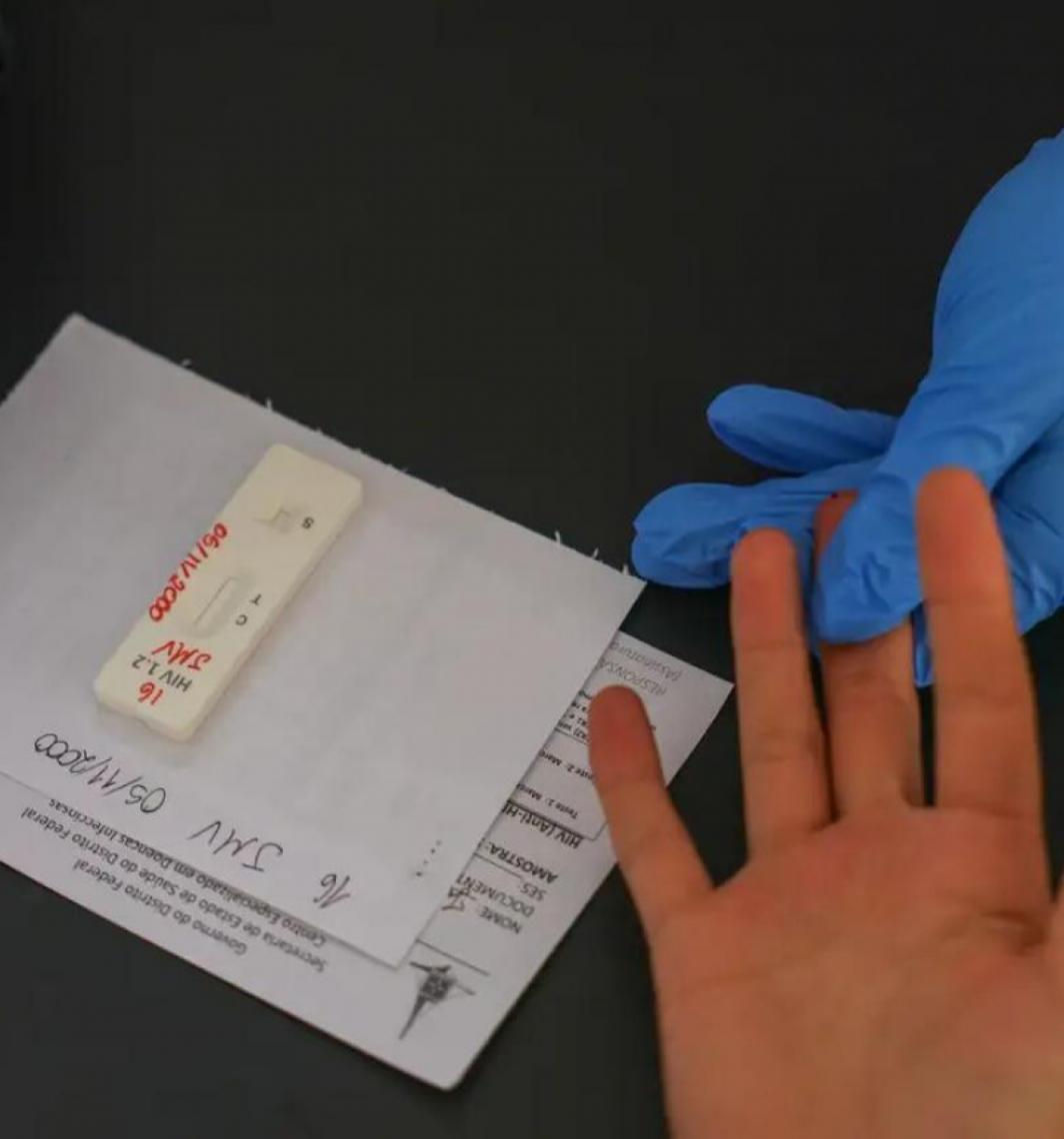 Estudo inédito da Fundação Oswaldo Cruz-Fiocruz pode ampliar prevenção de HIV entre jovens