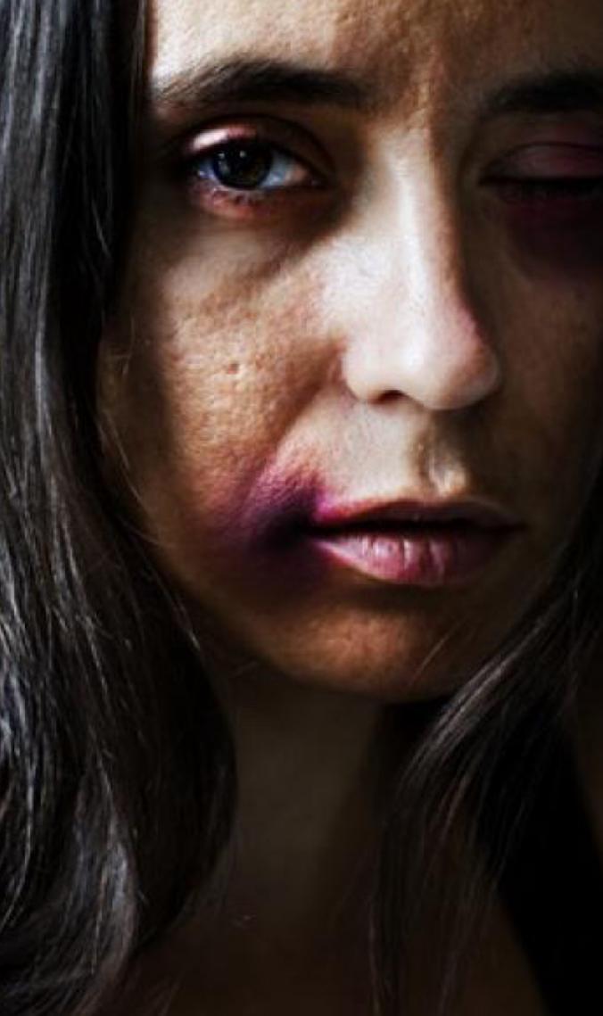 Ministério da Saúde reforça atuação integrada no enfrentamento ao feminicídio