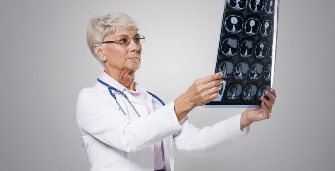 Esclerose múltipla no Brasil tem novo tratamento com anticorpo aprovado pela Anvisa