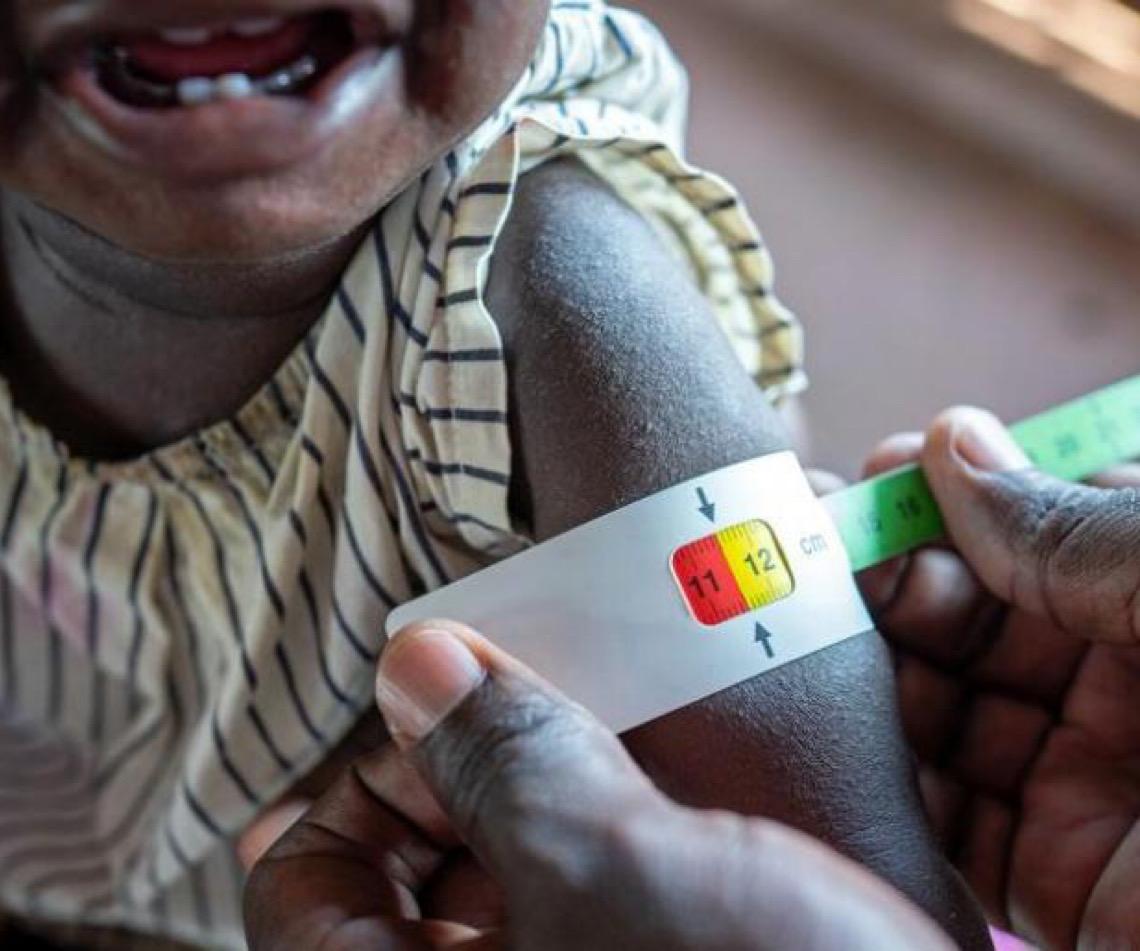 Relatório alerta; insegurança alimentar cresce no mundo e pode se agravar