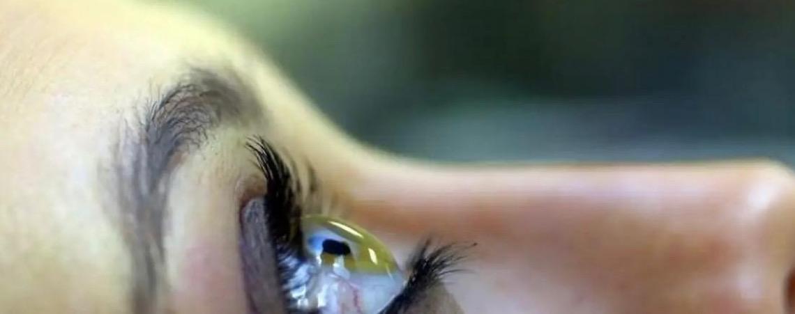 Oftalmologistas lançam campanha 24 Horas pelo Glaucoma - 24 Dias de Cuidado