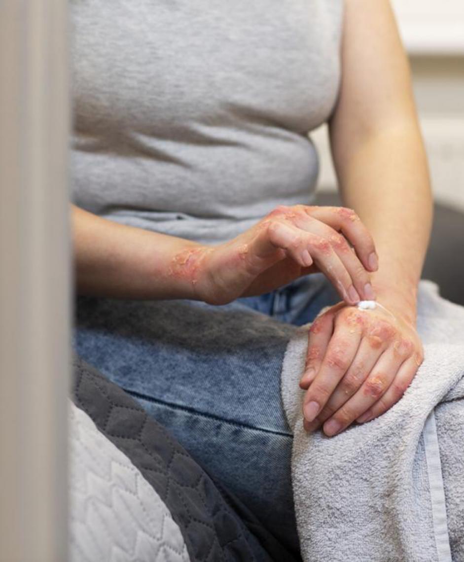 Especialista reforça importância de reconhecer os sintomas do Lúpus