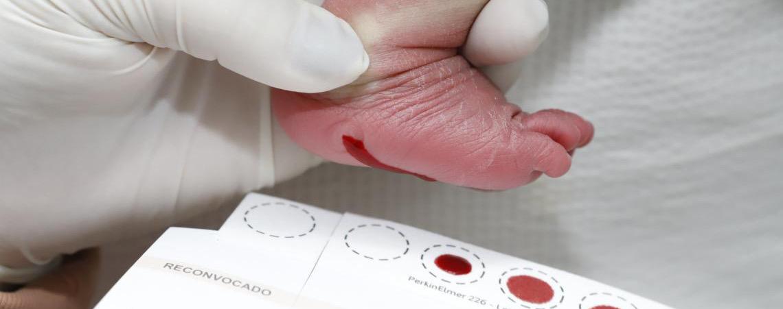 Diagnóstico precoce pelo Teste do Pezinho transforma a vida de crianças com doenças raras