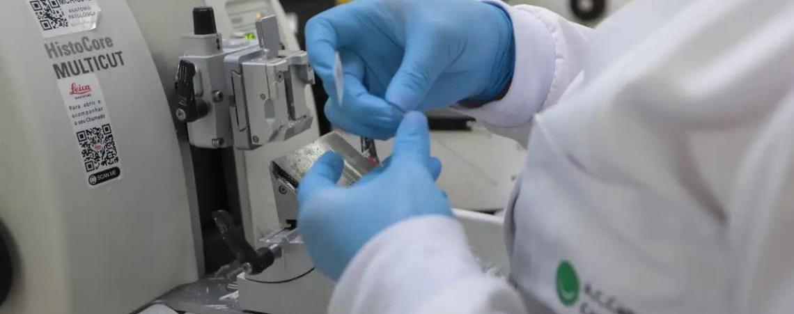 Sistema Único de Saúde incorpora medicamento para tratamento de leucemia mielóide aguda