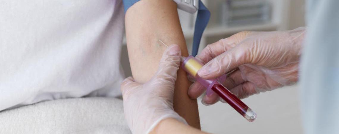 Junho Laranja: Saiba por que é importante avaliar a saúde do sangue e como fazer