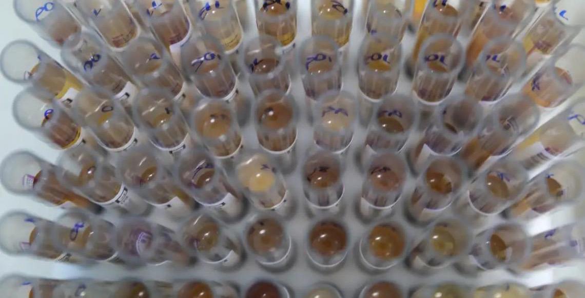 Uso de medicamento oferecido no Sistema Único de Saúde reduz casos de malária no Brasil