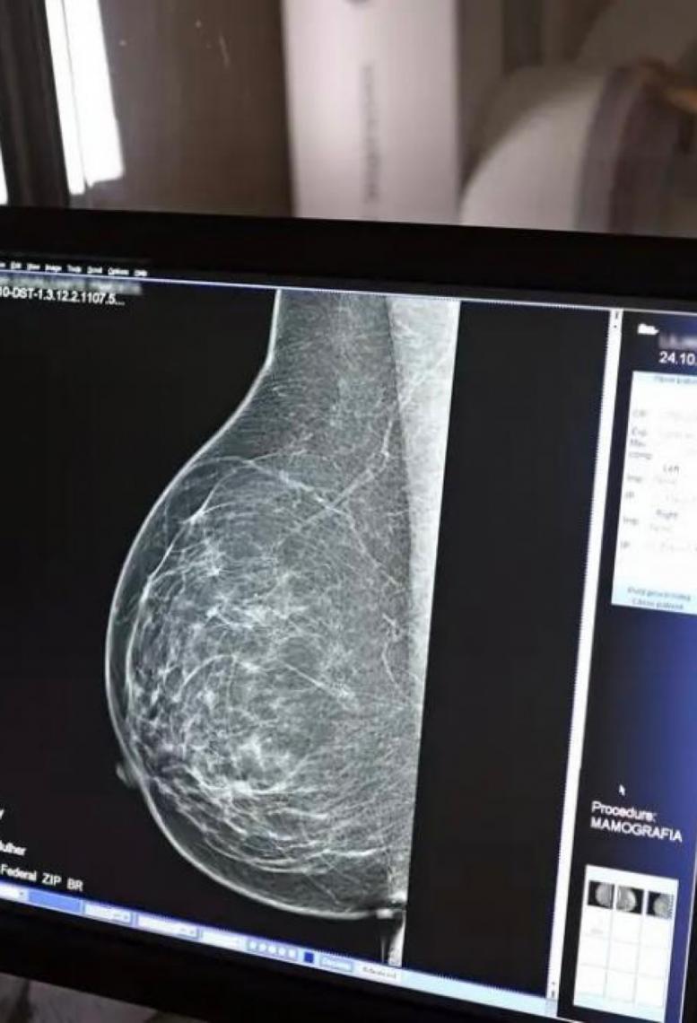 Plano de saúde terá que cobrir mamografia digital para todas as idades