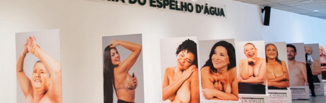 Exposição fotográfica “Cicatrizes” alerta sobre o câncer de mama, como parte do Outubro Rosa